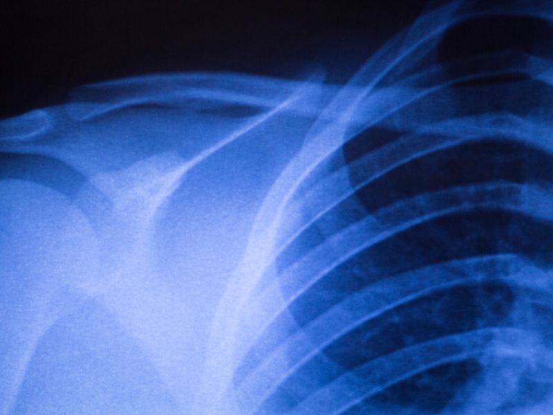 Thorax-Trauma Motorsport